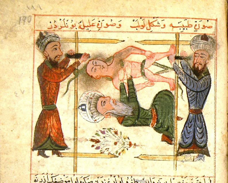 Illustrated surgery in Cerrahiyyetü’l-Hâniyye